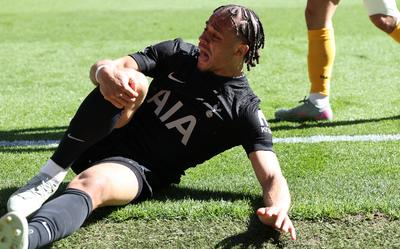 Xavi Simons heeft de voorste kruisband in zijn rechterknie gescheurd.